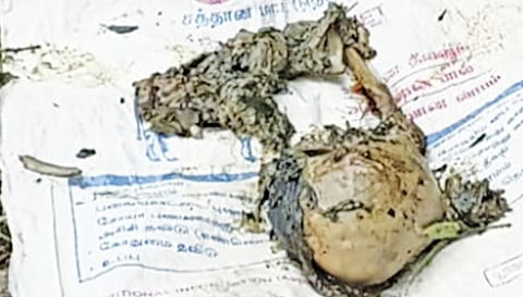 அழுகியநிலையில் உள்ள மனித மண்டை ஓடு.