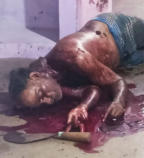 என்.எல்.சி. தொழிலாளி பிணமாக கிடக்கும் காட்சி. 