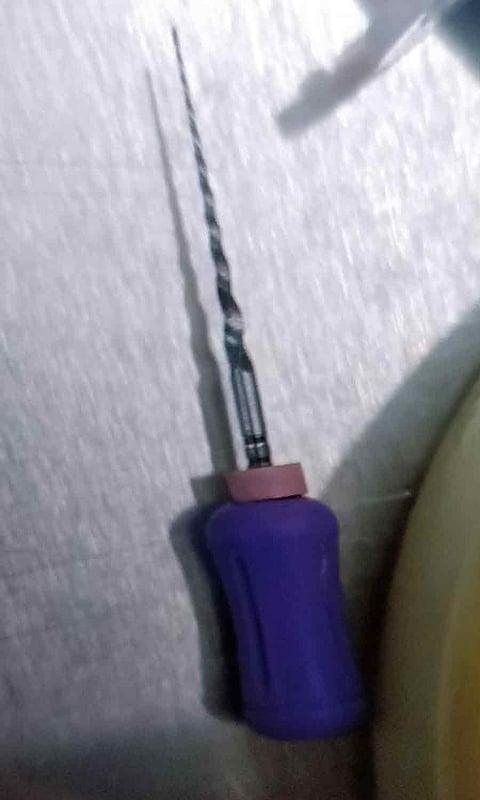 வாலிபர் வயிற்றில் சிக்கிய சிறு இரும்பு துண்டு