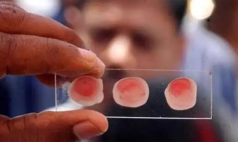 'தங்க ரத்தம்' பற்றி தெரியுமா?