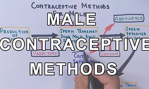 ஆண்கள் கருத்தடை சிகிச்சை மேற்கொண்டால் 'அந்த' பிரச்சனை வருமா?