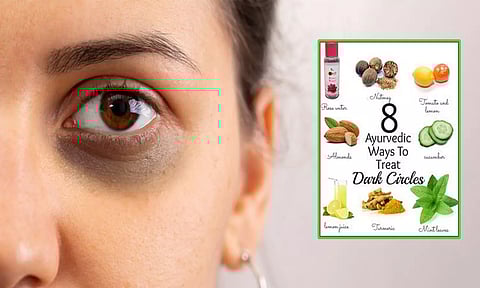 கண்ணுக்கு கீழ் கருவளையமும்... சித்த மருந்துகளும்....