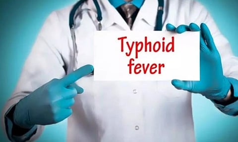 சென்னை மக்களே உஷார்- டைபாய்டு காய்ச்சல் பரவுகிறது