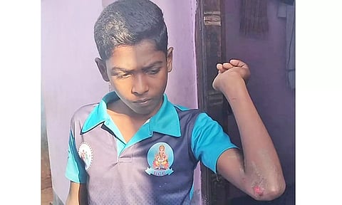 கடையத்தில் காட்டுப்பன்றி தாக்கி பள்ளி மாணவன்-மாணவி காயம்