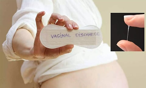 வெள்ளைப்படுதல் பிரச்சனையும்... சித்த மருத்துவத்தீர்வும்...