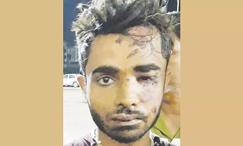 ரெயில் பயணிகளை எரித்து கொன்ற ஷாரூக் ஷபிக்கு கோவை கார் குண்டு வெடிப்பில் தொடர்பா?