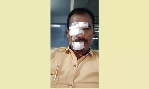 காயம் அடைந்த செந்தில்குமார்.