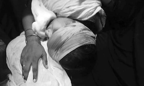 கல்வீச்சில் காயமடைந்த கலா