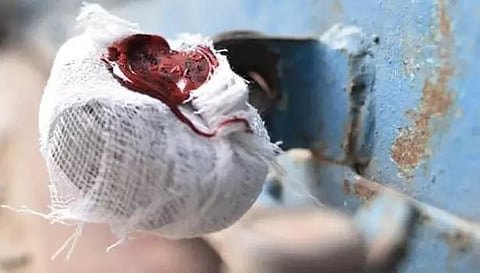 பல ஆண்டுகளாக வாடகை செலுத்தாமல் இருந்த 35 கடைகளுக்கு 'சீல்'