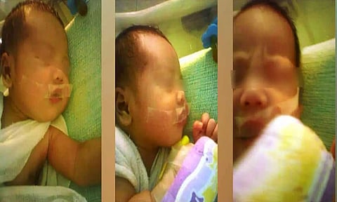 குழந்தையின் வாயில் டேப் ஒட்டப்பட்டு இருப்பதை படத்தில் காணலாம்.