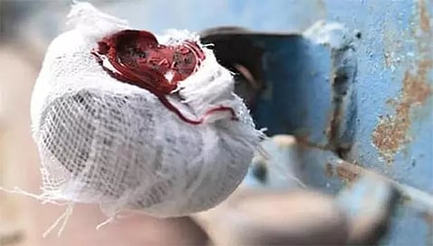 சேலம் மாவட்டத்தில் 17 டாஸ்மாக் கடைகள் மூடி சீல் வைப்பு