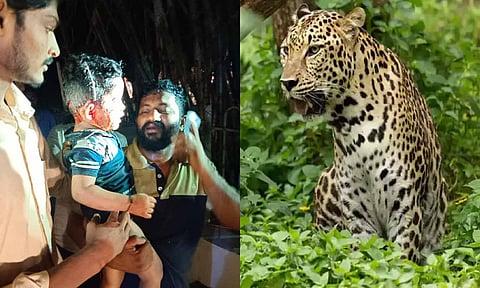 திருப்பதி மலைப்பாதையில் சிறுவனை கவ்வி சென்ற சிறுத்தையை பிடிக்க நடவடிக்கை- கேமரா மூலம் தீவிர கண்காணிப்பு