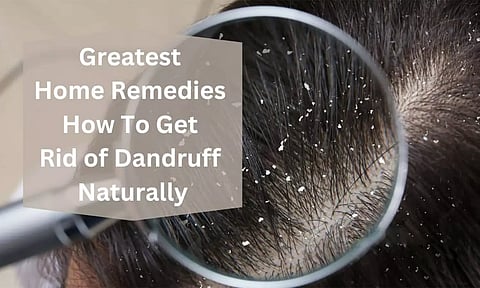 பொடுகுத் தொல்லையா? சமையல் அறையில் இருக்கும் பொருள்களே தீர்வு தரும்...