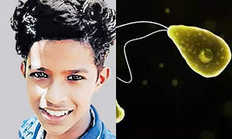 நீரில் வாழும் அமீபாவால் அபூர்வ மூளை தொற்று நோய்- சிறுவன் பலி