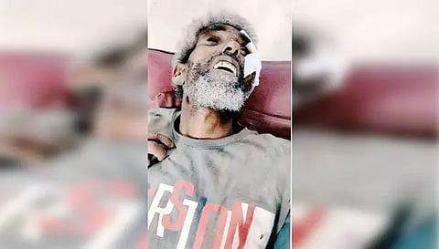 இருசக்கர வாகனம் மோதி மனநலம் பாதித்தவர் பலி
