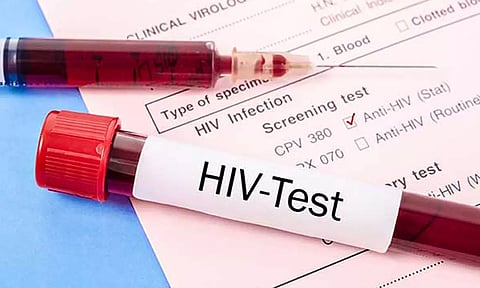 உ.பி அரசு மருத்துவமனையில் 80 கர்ப்பிணி பெண்களுக்கு எச்ஐவி பாதிப்பு