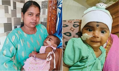 அரிய வகை நோய் பாதிப்பு: 17 கோடி ரூபாய் ஊசிக்கு ஏங்கிய 6 மாத குழந்தை பரிதாப பலி