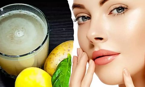 முகத்தில் அம்மை வடு, தழும்பு, காயங்கள் போகணுமா? இதை செய்து பாருங்கள்