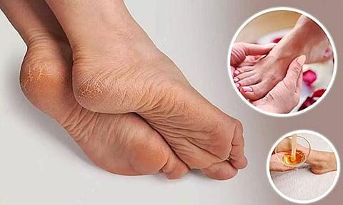 பாதங்களை பாதுகாப்பது எப்படி?