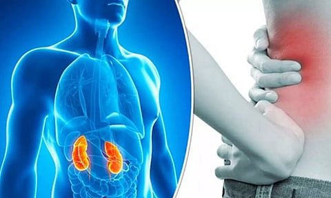 சிறுநீரக பாதிப்பின் அறிகுறிகள்