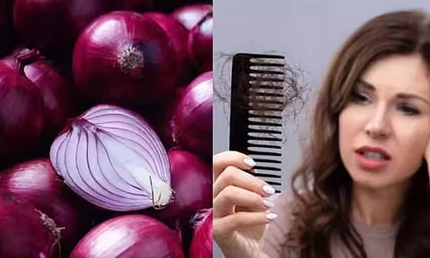 முடி உதிர்வை தவிர்க்க என்ன வழி?