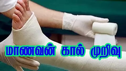 மாடியில் இருந்து தவறி விழுந்த மாணவன் கால் முறிவு