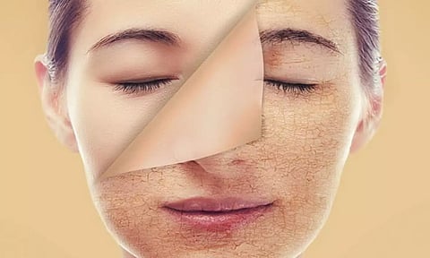 சுருக்கங்கள் நீங்கி மென்மையான சருமத்தை பெறவேண்டுமா?