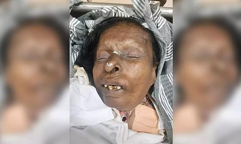 விபத்தில் பலியான மூதாட்டி.