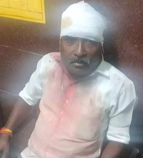 காயம் அடைந்த சங்கர்.