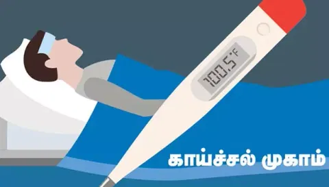 சேலம் மாவட்டத்தில் நாளை முதல்காய்ச்சல் பரவலை தடுக்க75 சிறப்பு மருத்துவ முகாம்கள்