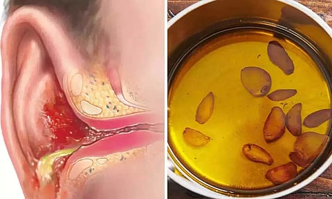 காதுவலிக்கு நிவாரணம் அளிக்கும் வீட்டு வைத்தியம்