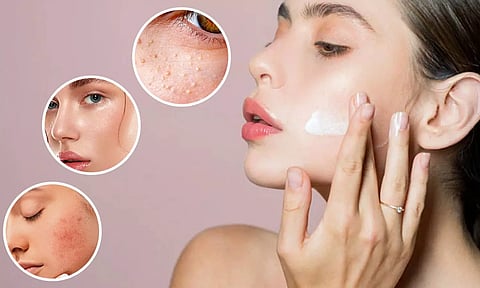 சரும பொலிவை அதிகரிக்கும் இயற்கை மாய்ஸ்சுரைசர்கள்