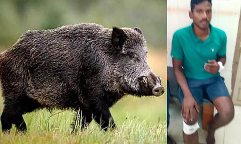 காயம் அடைந்த போலீஸ்காரர் மணிவண்ணன்.