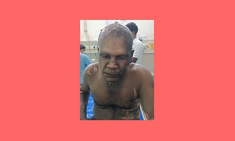 மின்சாரம் தாக்கியதில் மின் ஊழியர் படுகாயம்