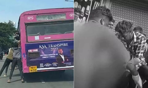 மாணவனின் நசுங்கிய இரு கால்களும் துண்டித்து அகற்றம்- சென்னை மாணவர்கள் இனியாவது திருந்துவார்களா?