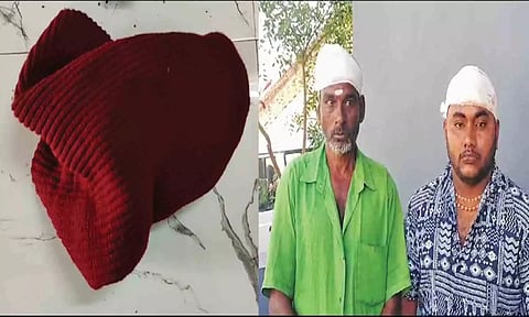 கொள்ளையர்கள் விட்டு சென்ற முகமூடி. கும்பல் தாக்கியதில் காயமடைந்தவர்கள்.