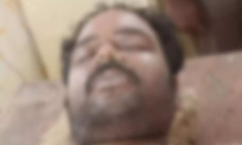 நிலக்கோட்டை அருகே பரோட்டா சாப்பிட்ட லாரி டிரைவர் மரணம்: போலீசார் விசாரணை