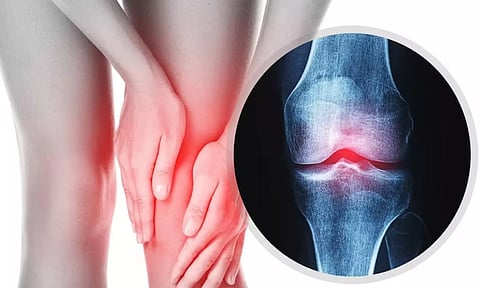 சித்தமருத்துவம்: மூட்டுகளில் வீக்கம், மூட்டுவலி