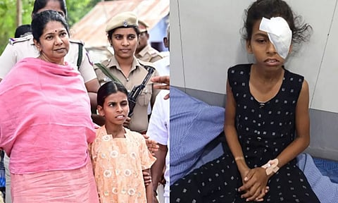 7-ம் வகுப்பு மாணவிக்கு மீண்டும் பார்வை கிடைக்க ஏற்பாடு செய்த கனிமொழி எம்.பி.