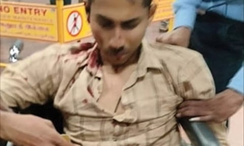 மெட்ரோ ரெயில் முன் பாய்ந்து கல்லூரி மாணவர் தற்கொலை முயற்சி