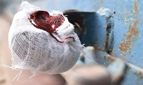 அண்ணாநகரில் 11 மசாஜ் மையங்களுக்கு போலீசார் சீல்