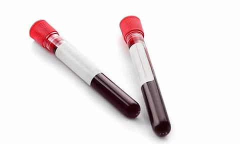 புதுச்சேரியில் படுகொலை செய்யப்பட்ட சிறுமியின் பெற்றோரிடம் ரத்த மாதிரி சேகரிப்பு