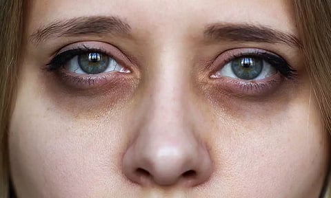 கண்களில் கருவளையம் நீங்க சில டிப்ஸ்கள்...!