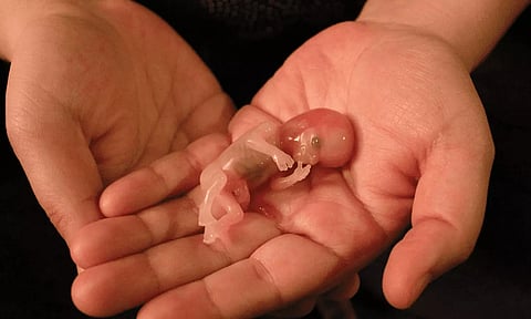 கருச்சிதைவு ஏன் உண்டாகிறது? காரணம் தான் என்ன...?