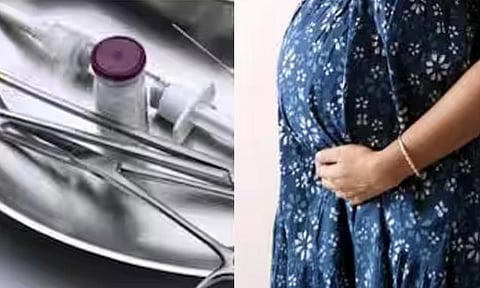 திருமணம் ஆகாமல் கர்ப்பம்- குழந்தையின் காலை வெட்டி எடுத்து தனக்கு தானே பிரசவம் பார்த்த நர்சு