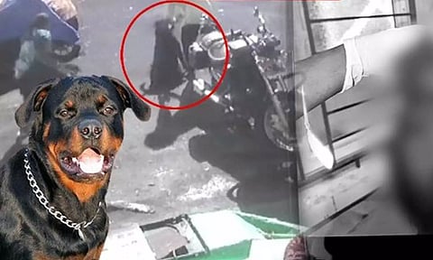 நாய் கடித்த சிறுமிக்கு 9-ம் தேதி அறுவை சிகிச்சை - சிறுமியின் தந்தை தகவல்