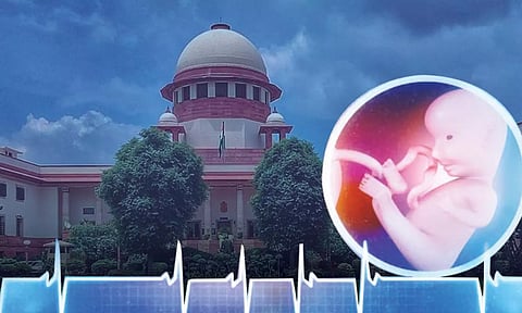 வயிற்றில் உள்ள கருவுக்கும் வாழ்வதற்கான அடிப்படை உரிமை உண்டு - உச்சநீதிமன்றம் தீர்ப்பு