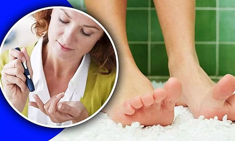 நீரிழிவு நோயாளிகள் பாதங்களை பாதுகாப்பது குறித்த நெறிமுறைகள்....