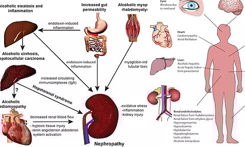 மெத்தனால் கலந்த சாராயம் குடித்தால் கல்லீரல், சிறுநீரகங்கள் முடங்கிவிடும்: வாழ்நாள் முழுக்க பாதிப்பு