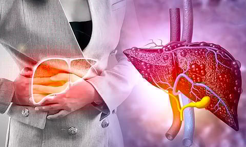 கல்லீரலில் கொழுப்பு படிவதன் காரணம் என்ன?